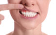 Periodontal (Gum) Disease 101